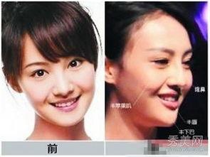 福州整形爆料事件真相视频,揭秘真相与争议  第3张